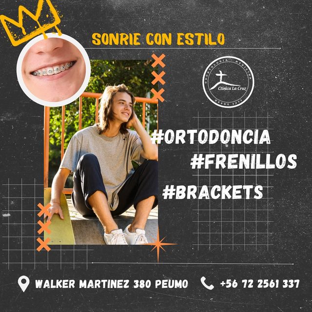 Pieza: Sonríe con estilo, ortodoncia y brackets